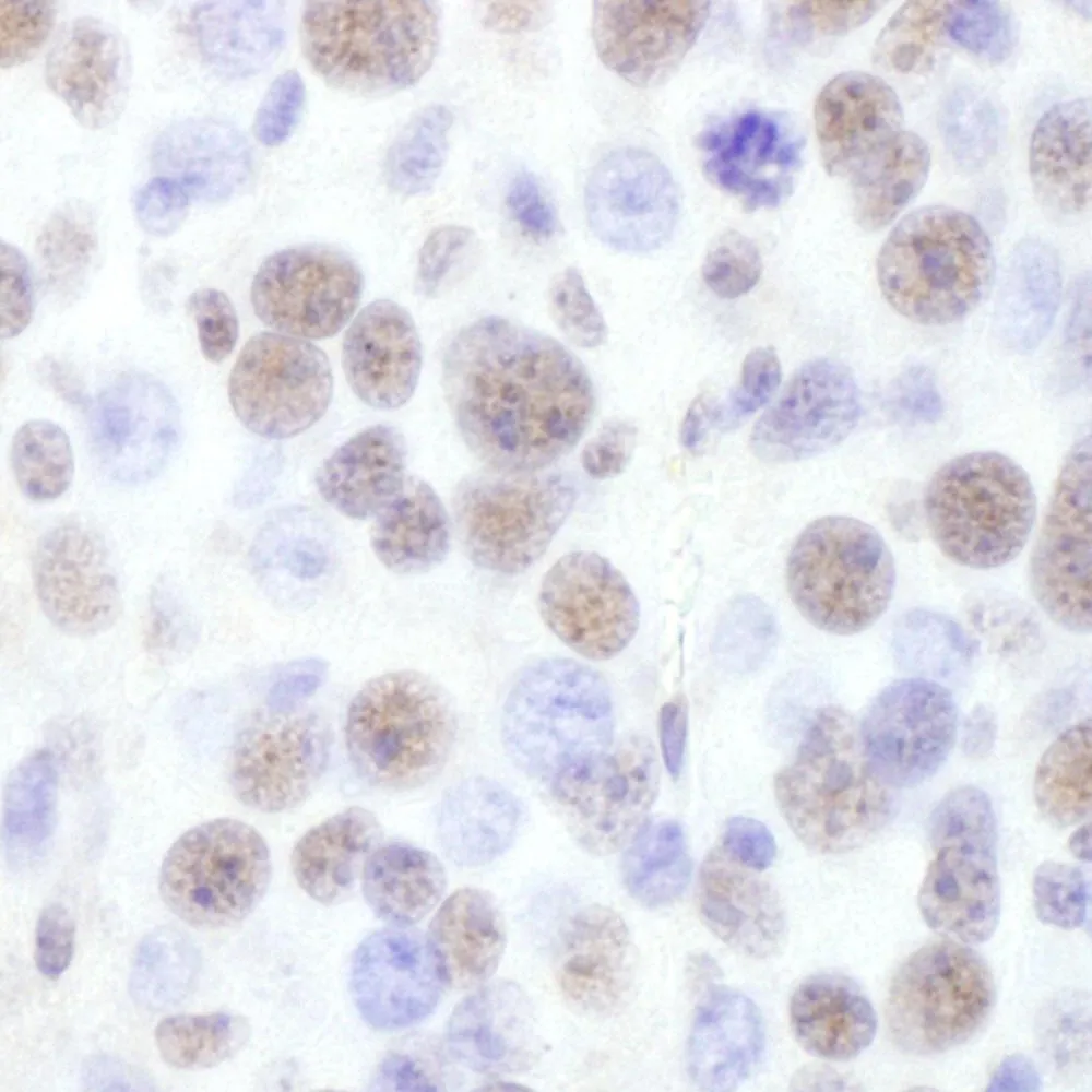 Goat anti-BRG1/SMARCA4 Antibody, Affinity Purified