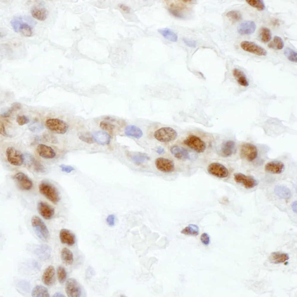 Rabbit anti-SS-B Antibody, Affinity Purified