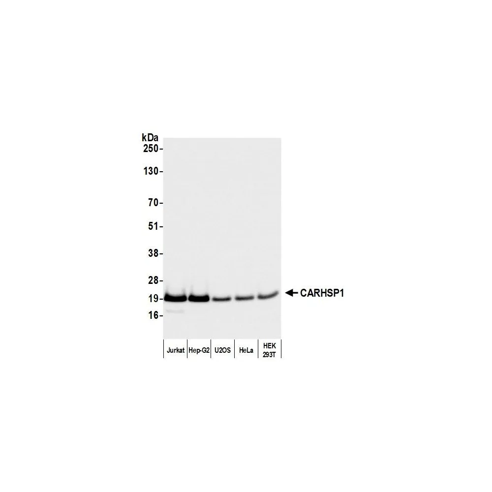 Rabbit anti-CARHSP1 Antibody, Affinity Purified