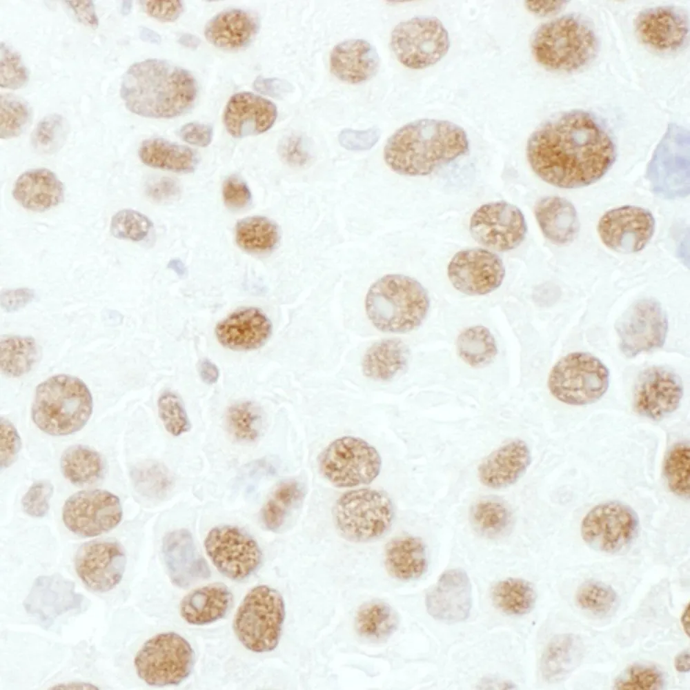 Rabbit anti-hnRNP M3/4 Antibody, Affinity Purified