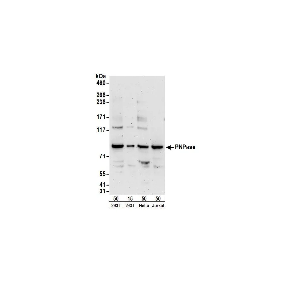 Rabbit anti-PNPase Antibody, Affinity Purified