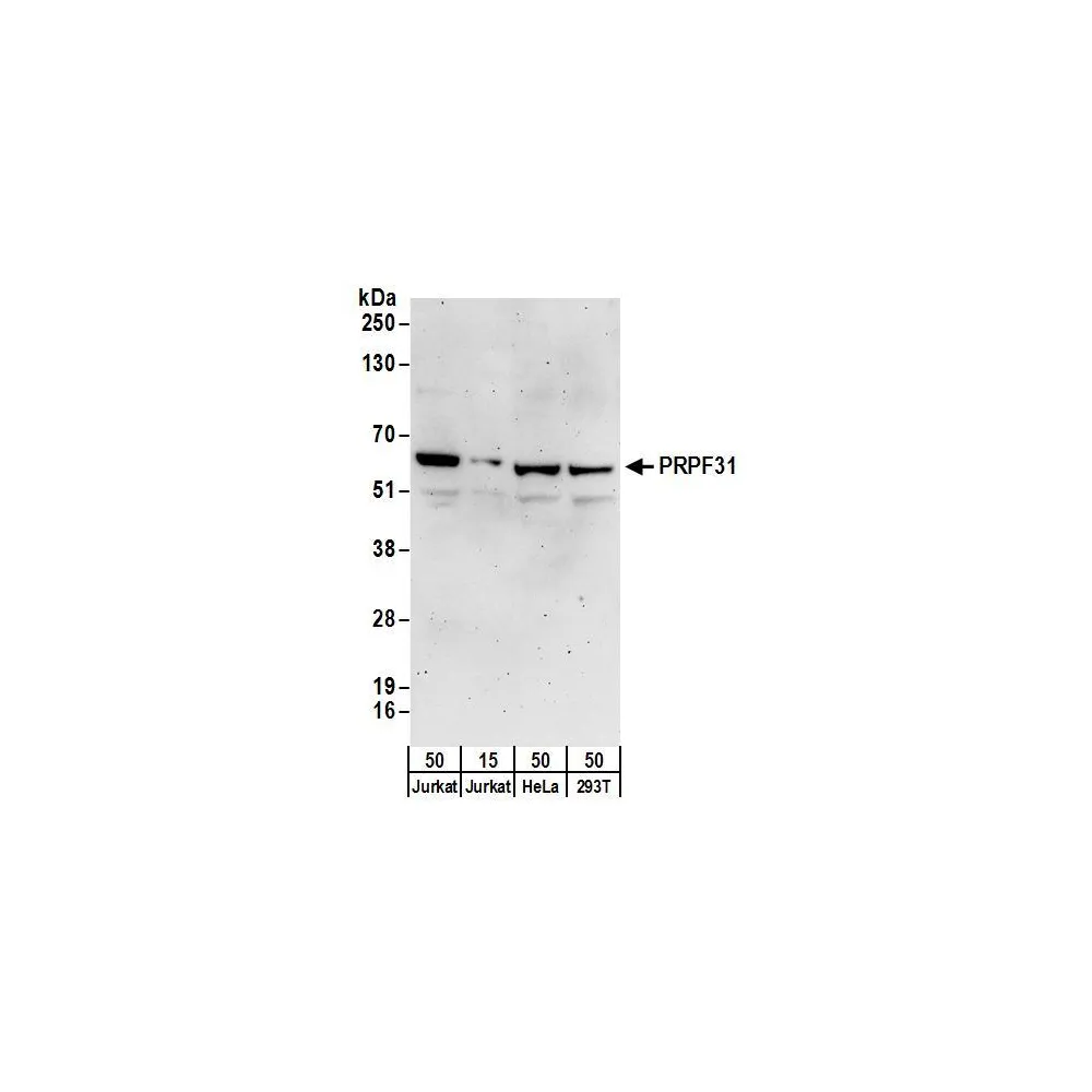 Rabbit anti-PRPF31 Antibody, Affinity Purified