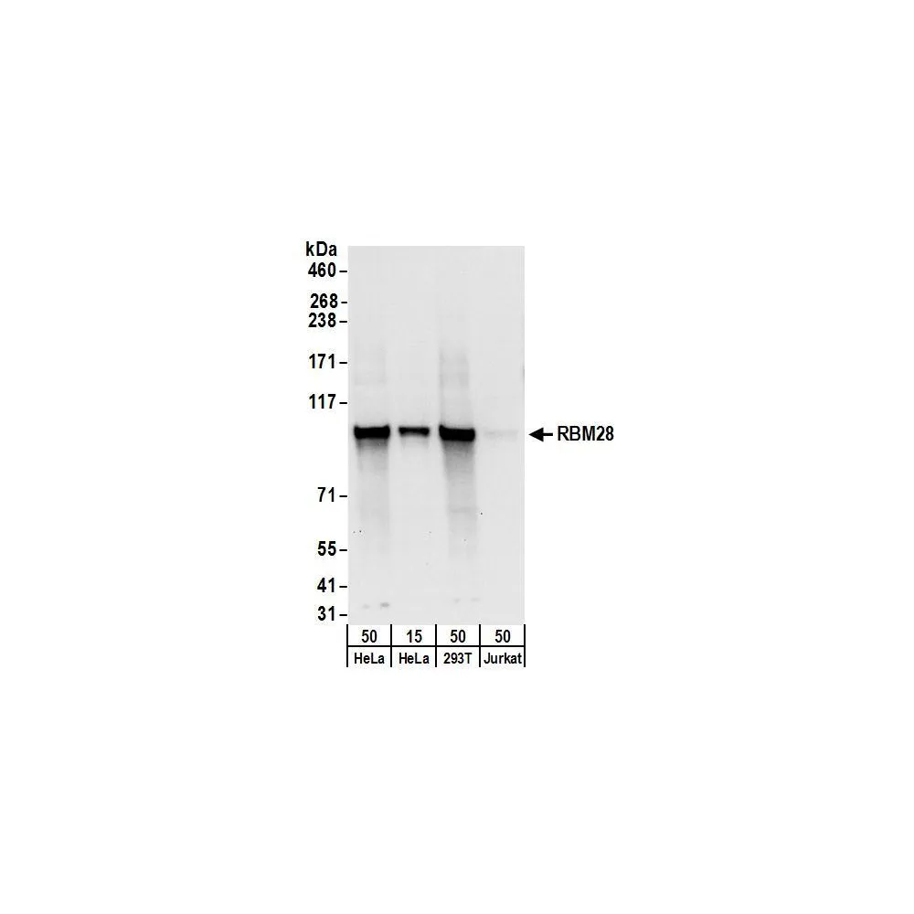 Rabbit anti-RBM28 Antibody, Affinity Purified