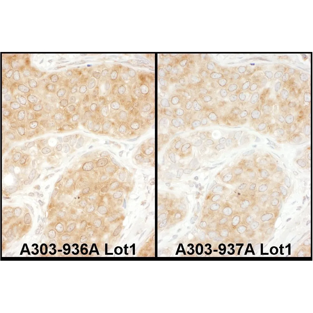 Rabbit anti-RPS11 Antibody, Affinity Purified