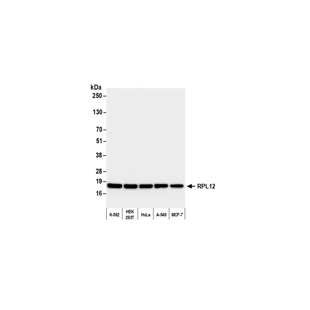 Rabbit anti-RPL12 Antibody, Affinity Purified