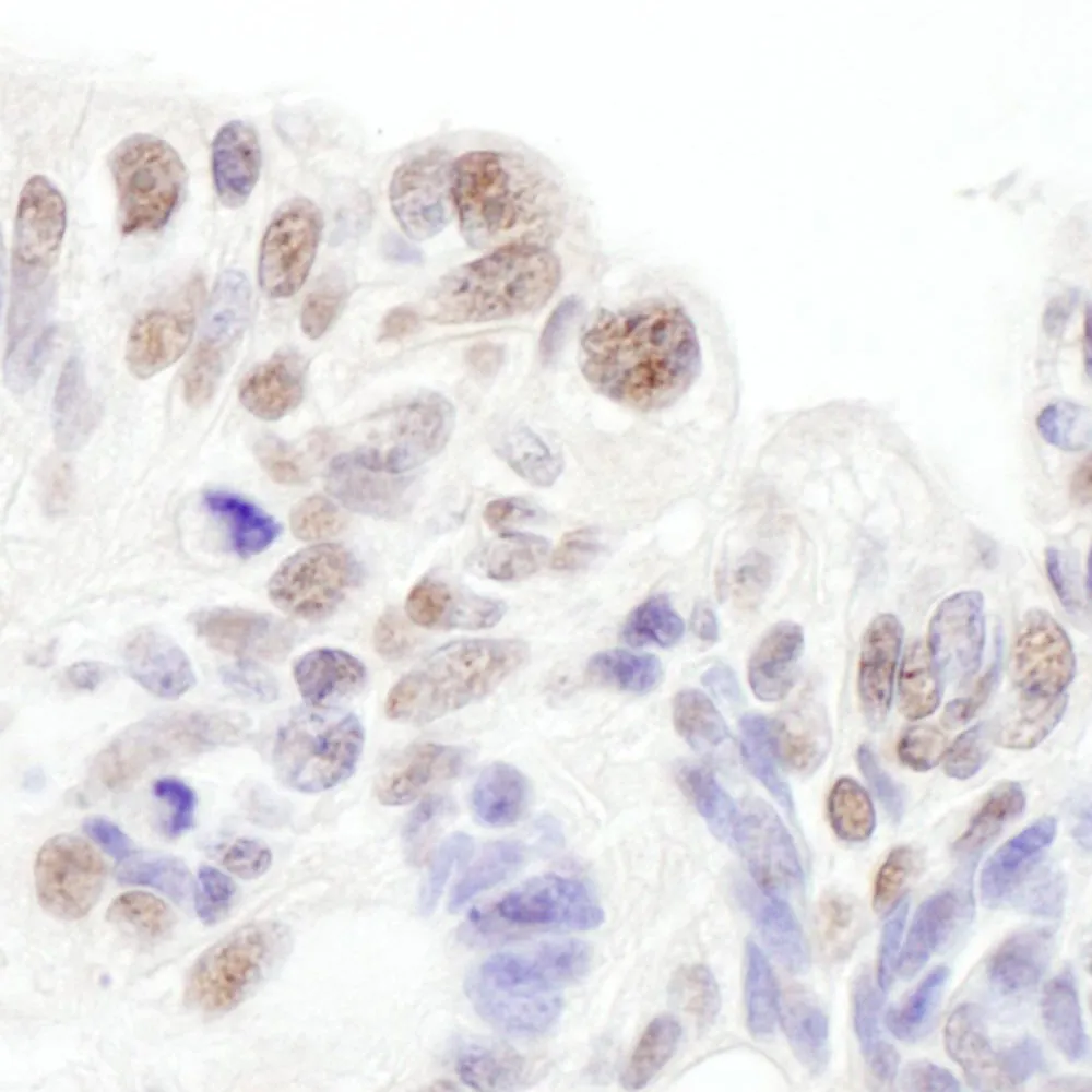 Rabbit anti-SNRPA1 Antibody, Affinity Purified