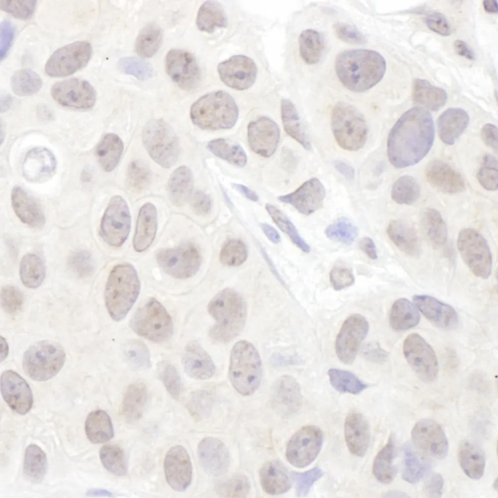 Rabbit anti-Sm-D3 Antibody, Affinity Purified