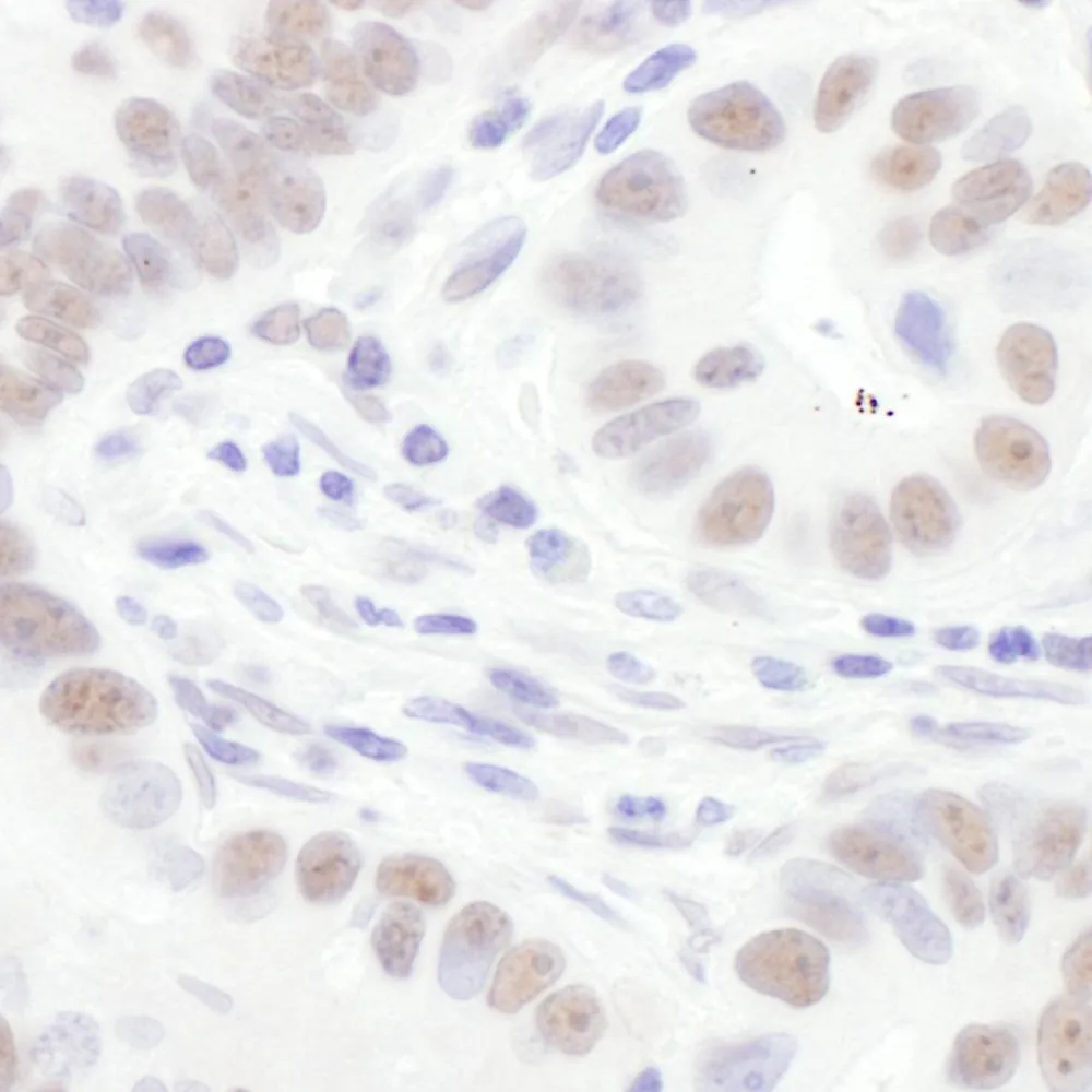 Rabbit anti-Sm-D3 Antibody, Affinity Purified