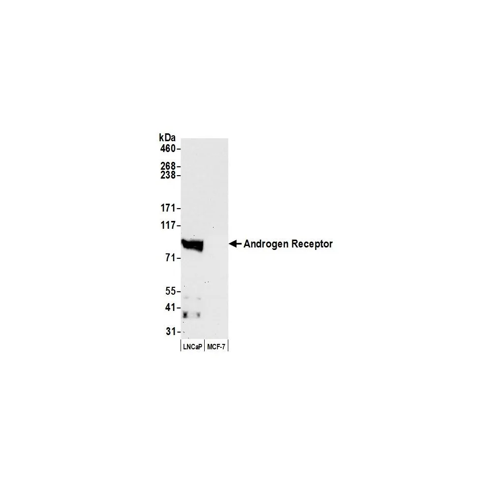 Rabbit anti-Androgen Receptor Antibody, Affinity Purified