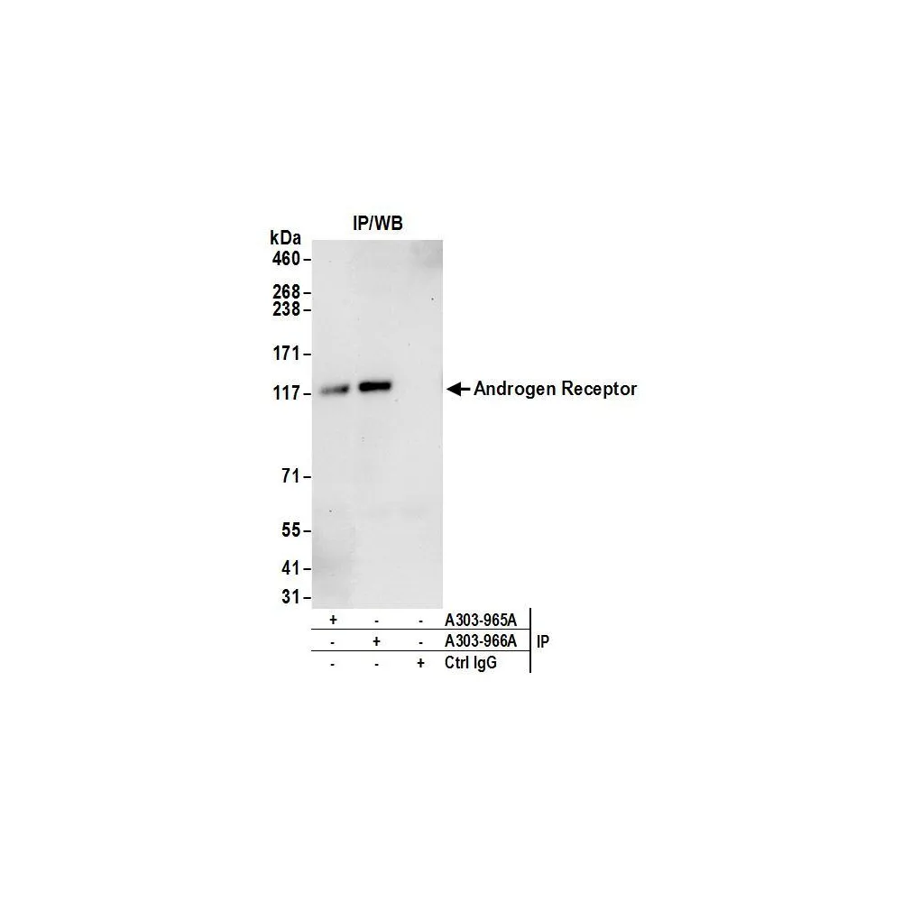 Rabbit anti-Androgen Receptor Antibody, Affinity Purified