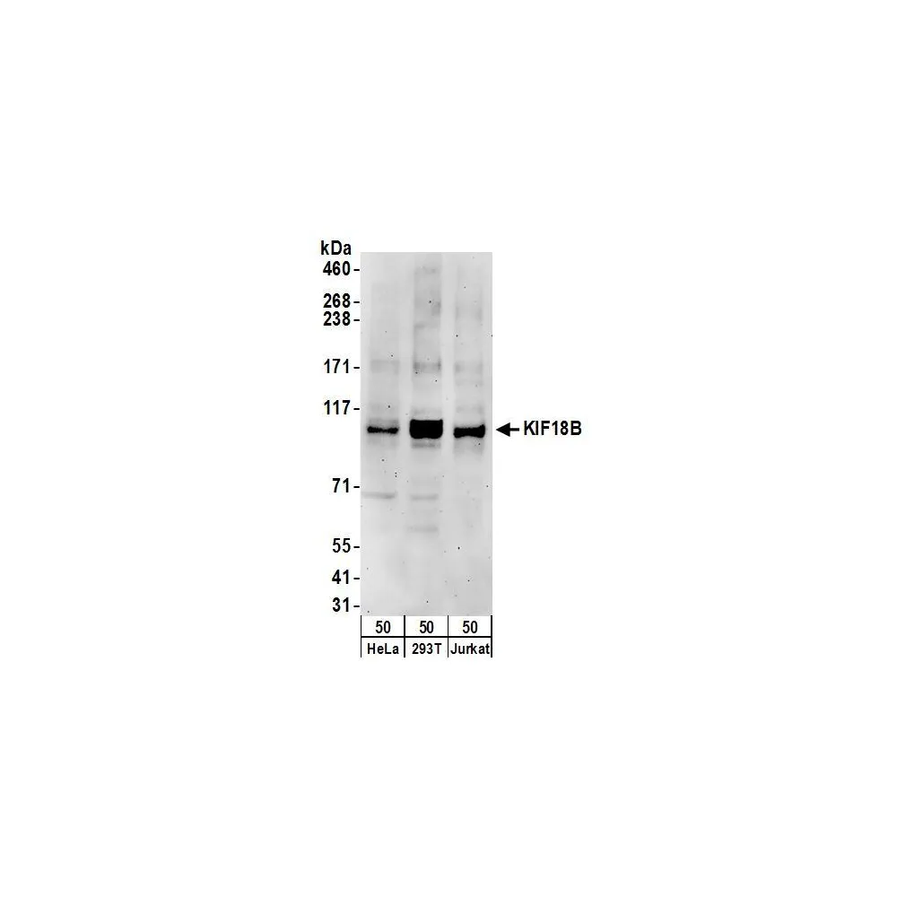 Rabbit anti-KIF18B Antibody, Affinity Purified