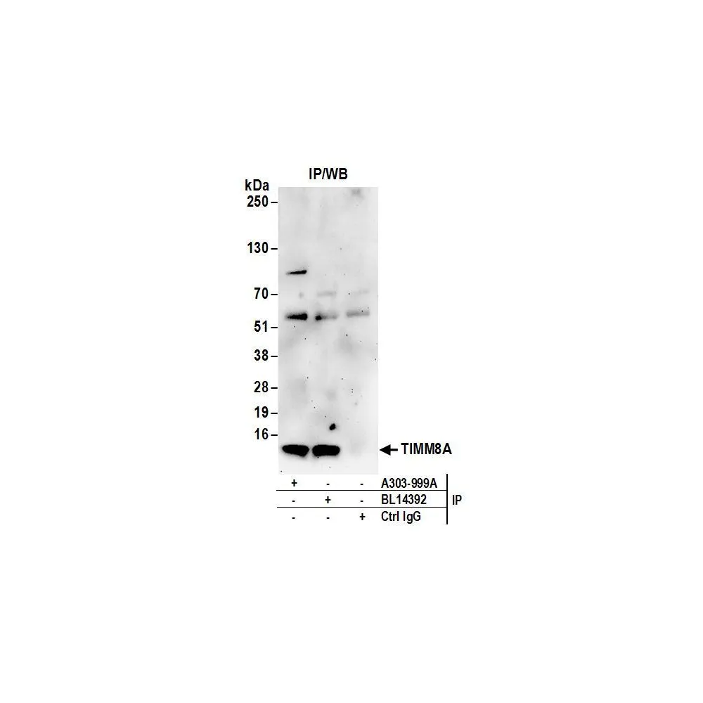 Rabbit anti-TIMM8A Antibody, Affinity Purified