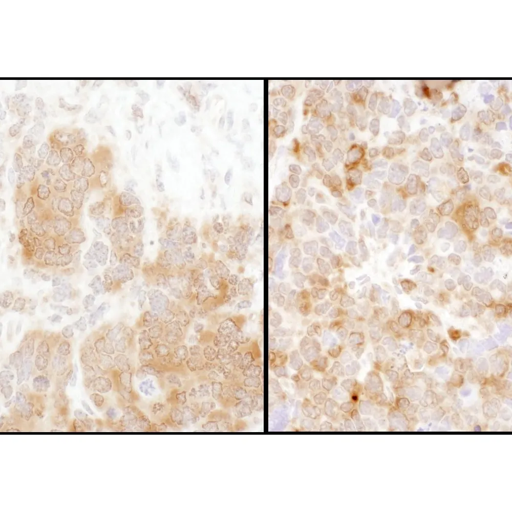Rabbit anti-TS Antibody, Affinity Purified