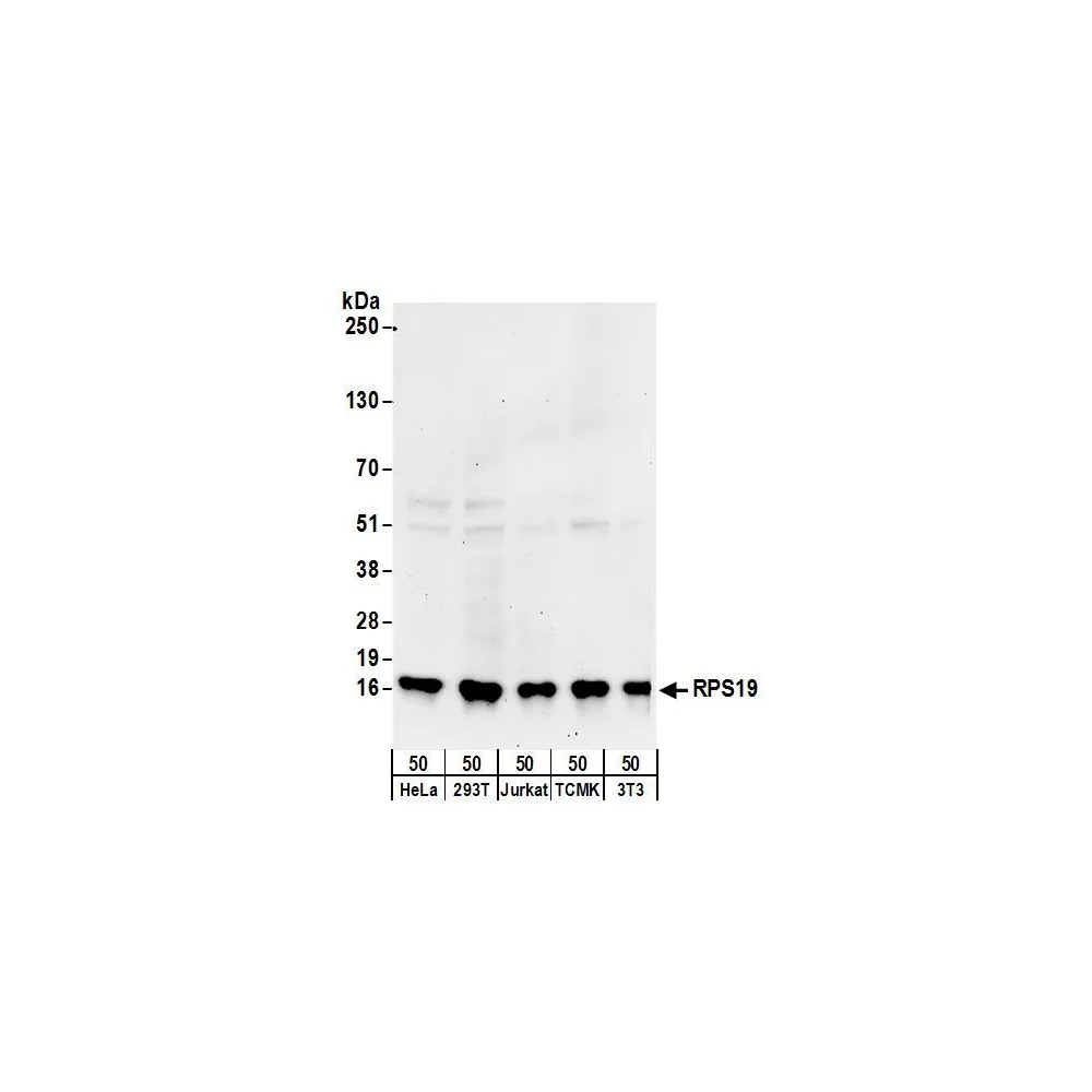 Rabbit anti-RPS19 Antibody, Affinity Purified