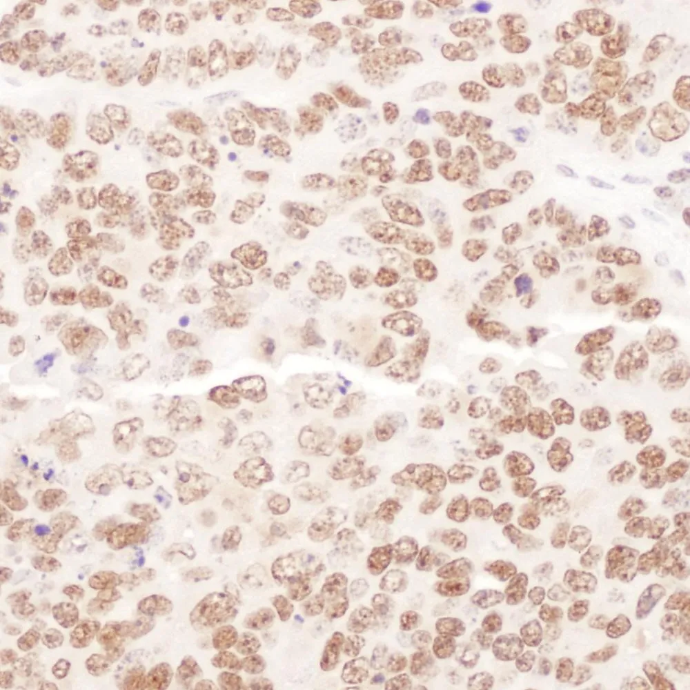 Rabbit anti-PolD1 Antibody, Affinity Purified