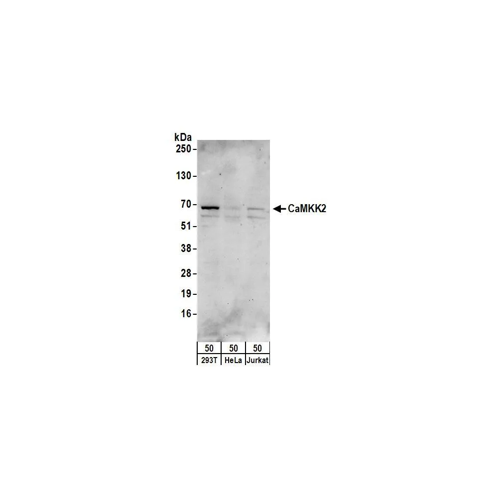Rabbit anti-CaMKK2 Antibody, Affinity Purified