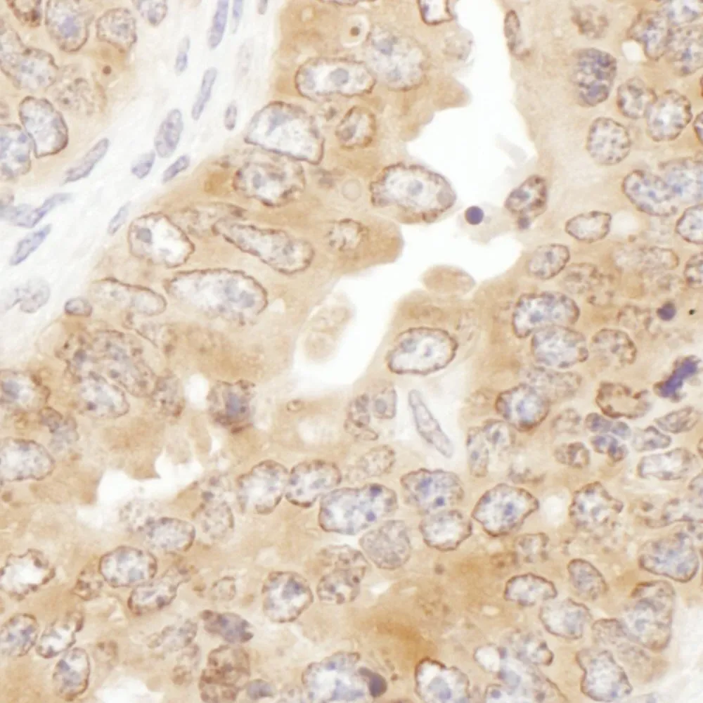 Rabbit anti-RPS5 Antibody, Affinity Purified