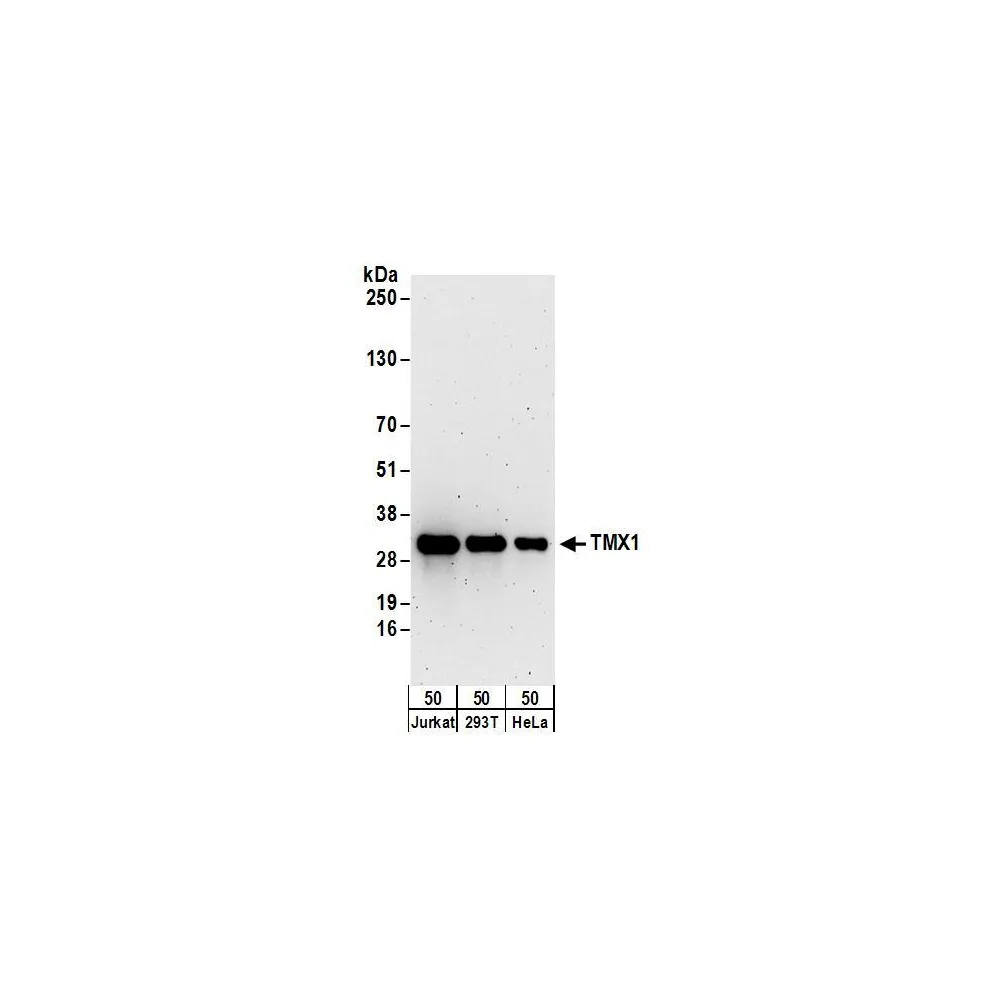 Rabbit anti-TMX1 Antibody, Affinity Purified