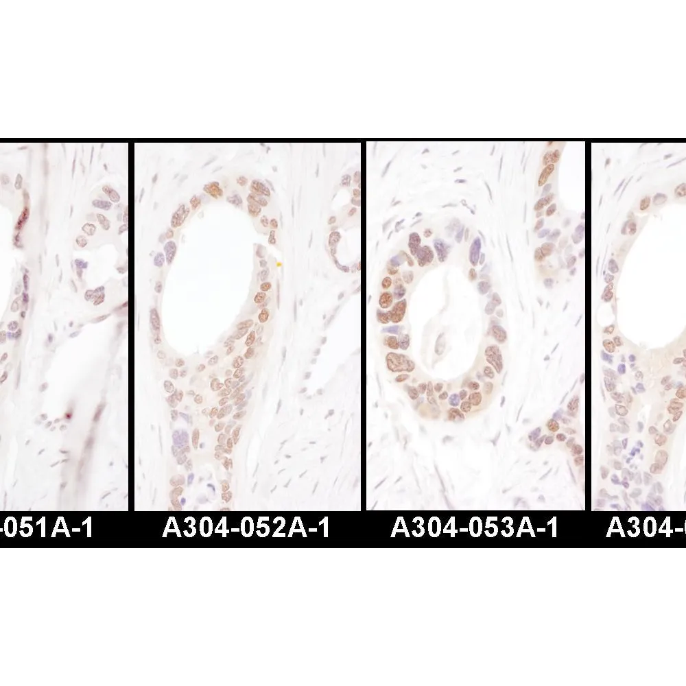 Rabbit anti-HNF1-alpha Antibody, Affinity Purified