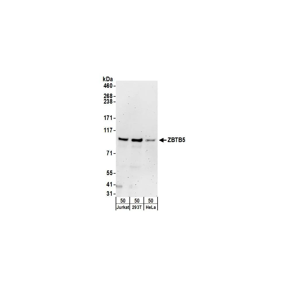 Rabbit anti-ZBTB5 Antibody, Affinity Purified