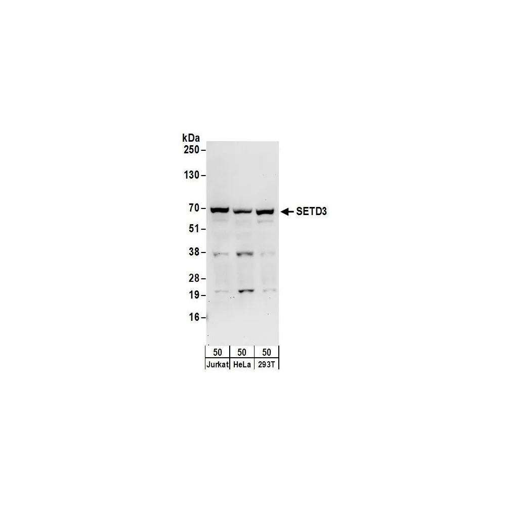 Rabbit anti-SETD3 Antibody, Affinity Purified