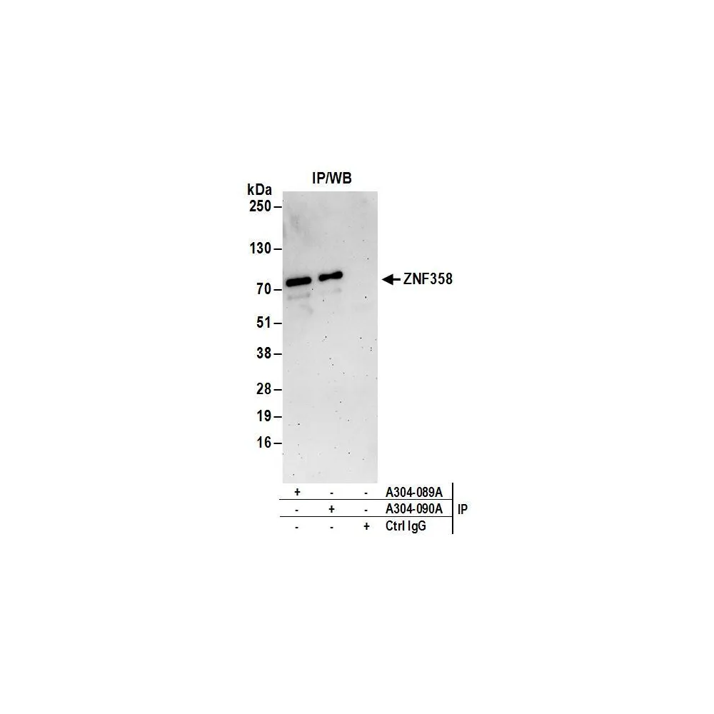 Rabbit anti-ZNF358 Antibody, Affinity Purified