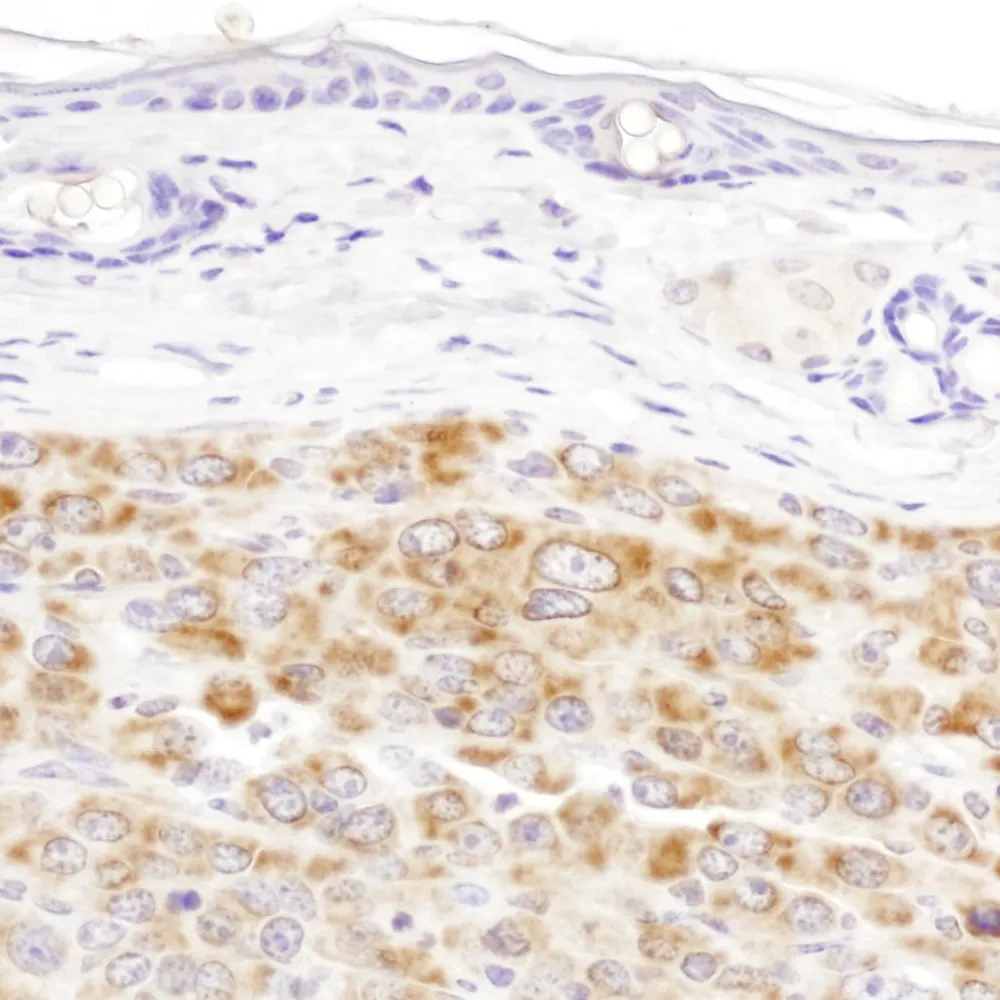 Rabbit anti-IDH2 Antibody, Affinity Purified