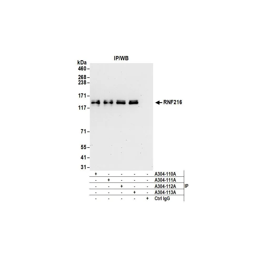 Rabbit anti-RNF216 Antibody, Affinity Purified