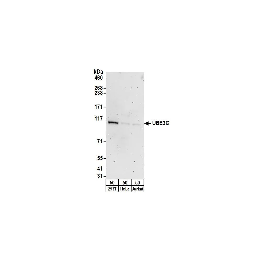 Rabbit anti-UBE3C Antibody, Affinity Purified