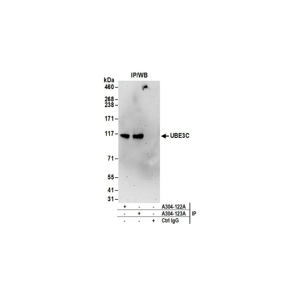 Rabbit anti-UBE3C Antibody, Affinity Purified