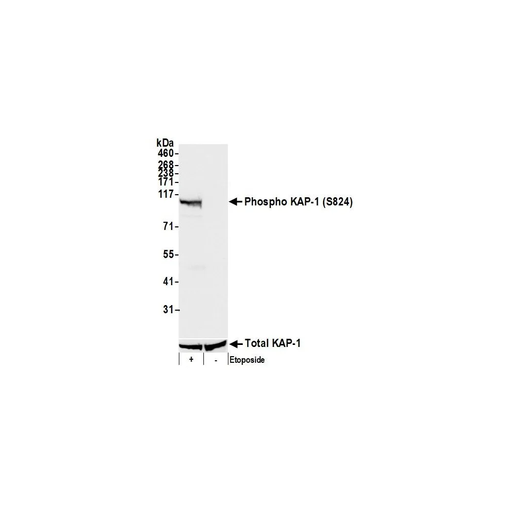 Rabbit anti-Phospho KAP-1 (S824) Antibody, Affinity Purified