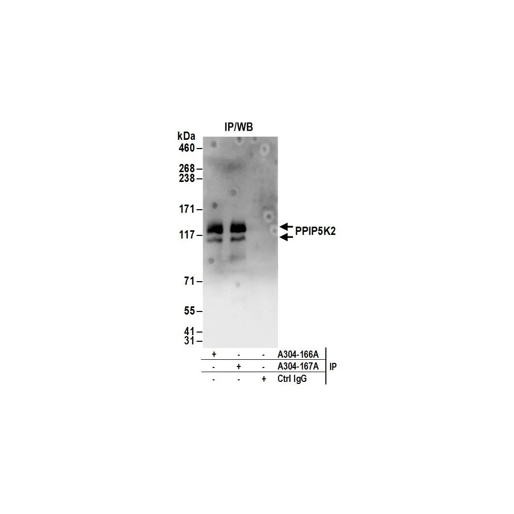 Rabbit anti-PPIP5K2 Antibody, Affinity Purified