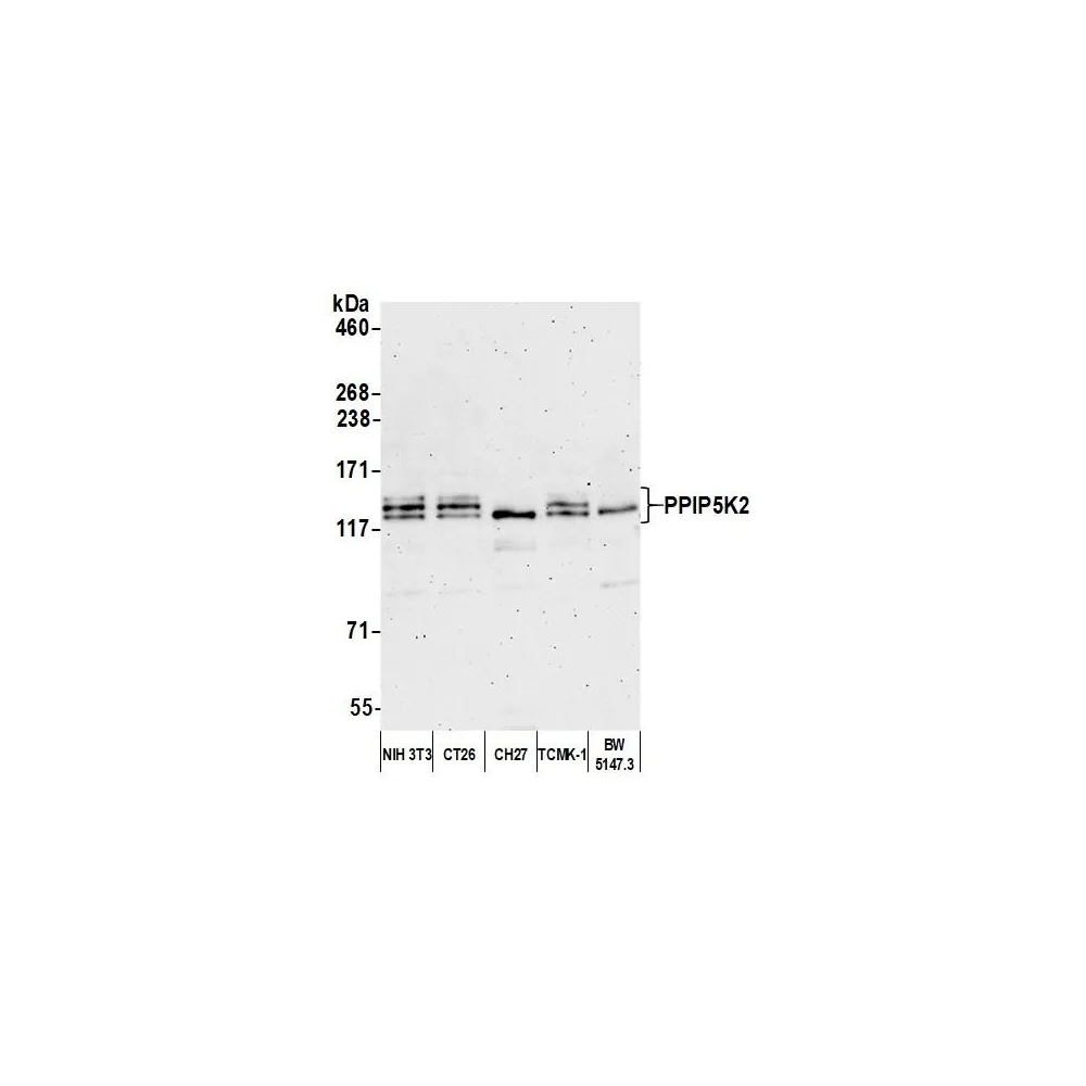 Rabbit anti-PPIP5K2 Antibody, Affinity Purified