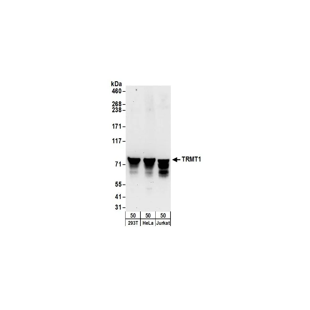 Rabbit anti-TRMT1 Antibody, Affinity Purified