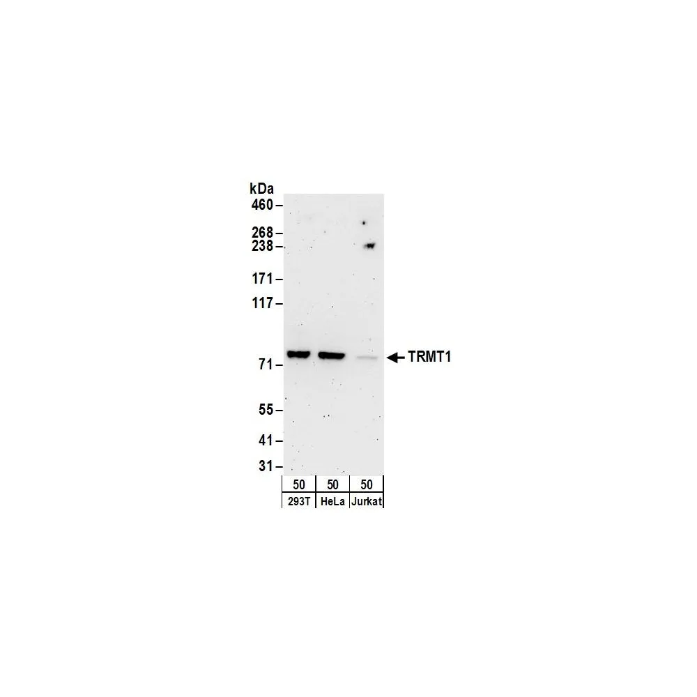 Rabbit anti-TRMT1 Antibody, Affinity Purified