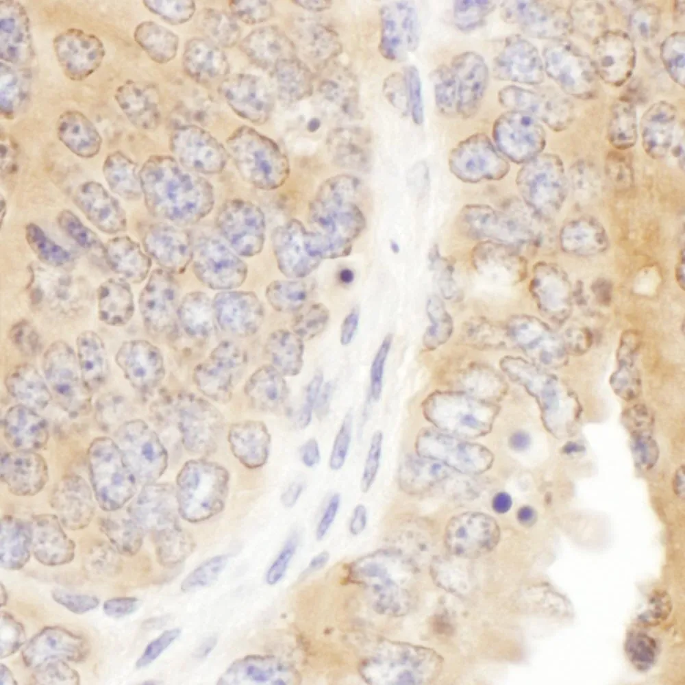 Rabbit anti-Septin 7 Antibody, Affinity Purified