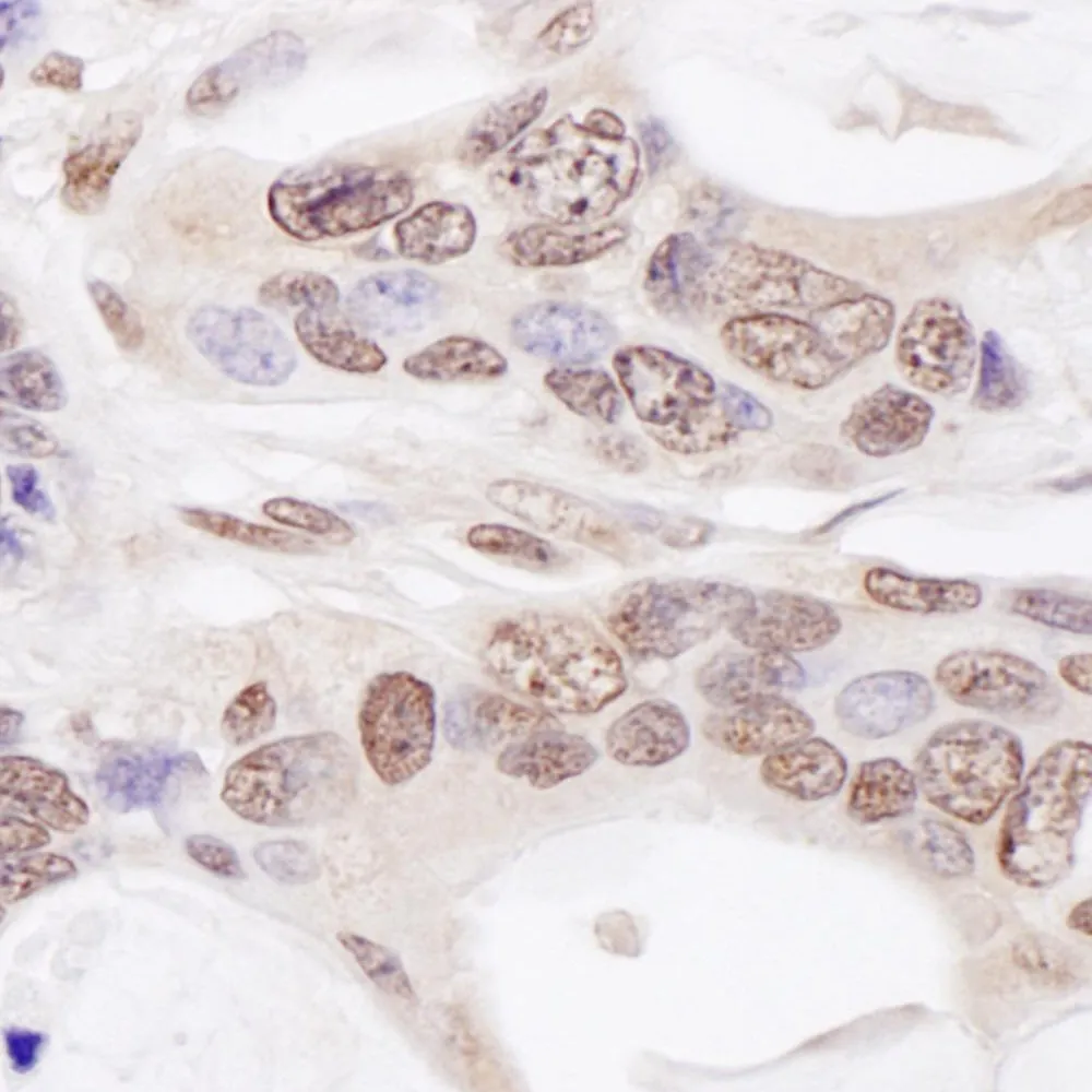 Rabbit anti-CHAMP1 Antibody, Affinity Purified