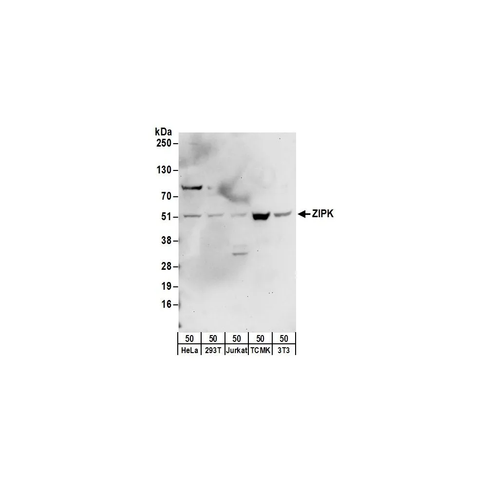 Rabbit anti-ZIPK Antibody, Affinity Purified