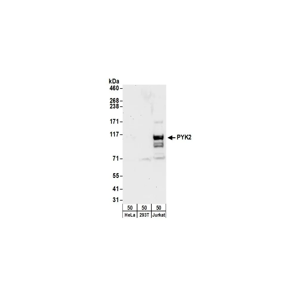 Rabbit anti-PYK2 Antibody, Affinity Purified