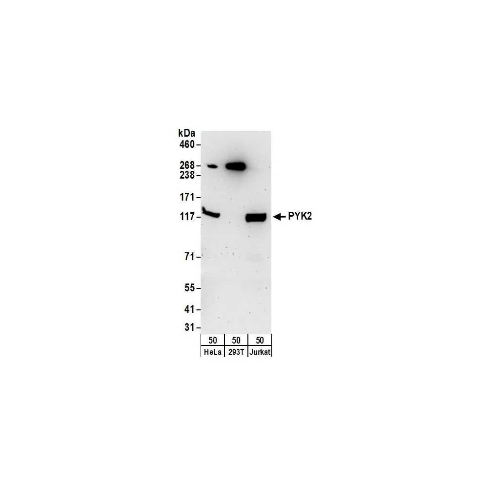 Rabbit anti-PYK2 Antibody, Affinity Purified