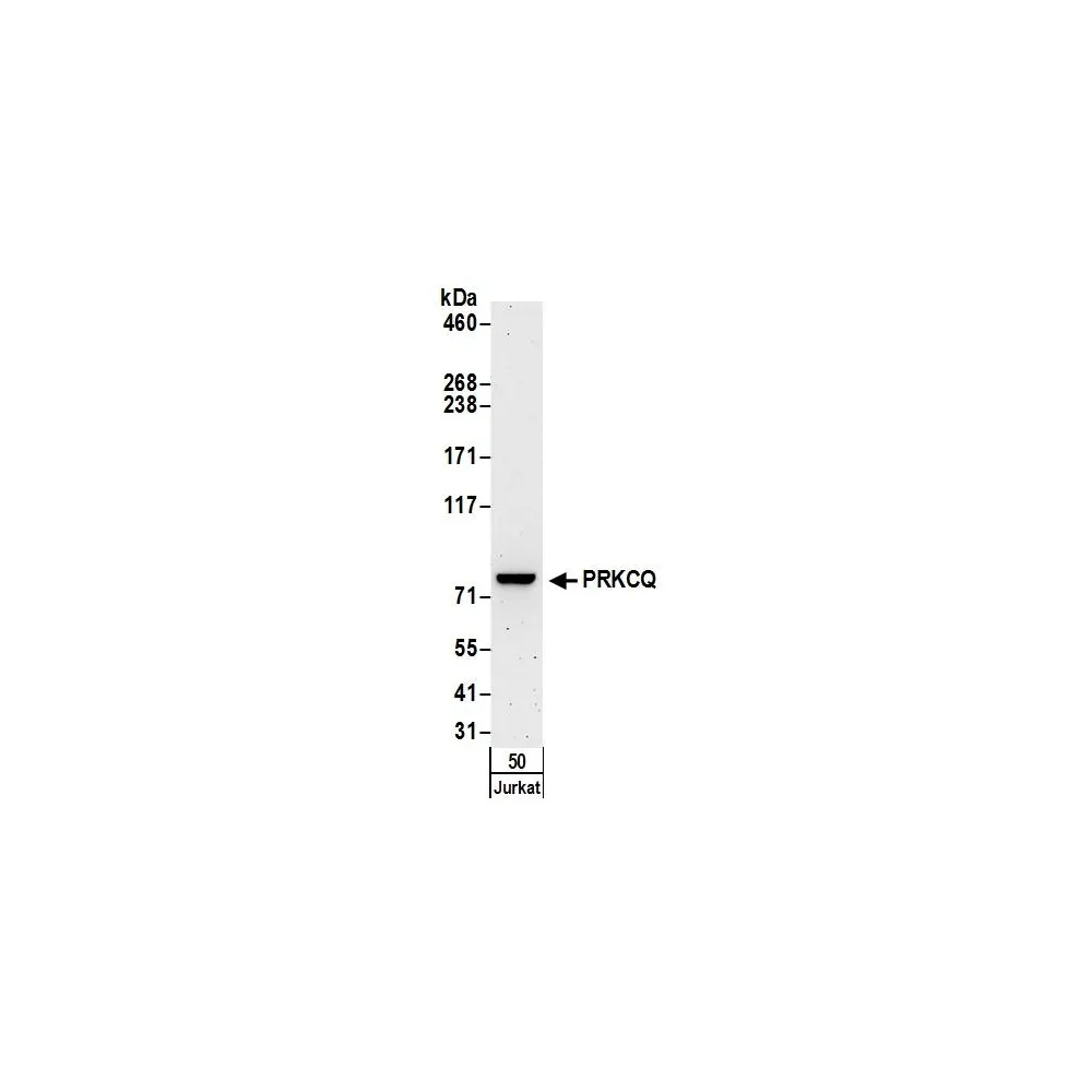 Rabbit anti-PRKCQ Antibody, Affinity Purified