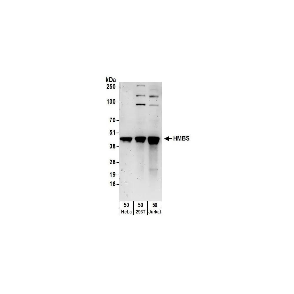 Rabbit anti-HMBS Antibody, Affinity Purified