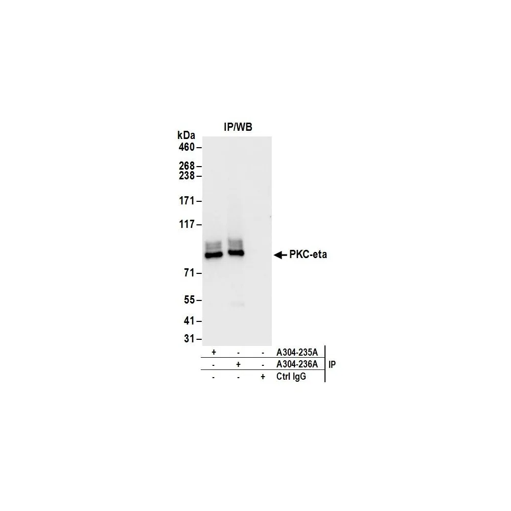 Rabbit anti-PKC-eta Antibody, Affinity Purified