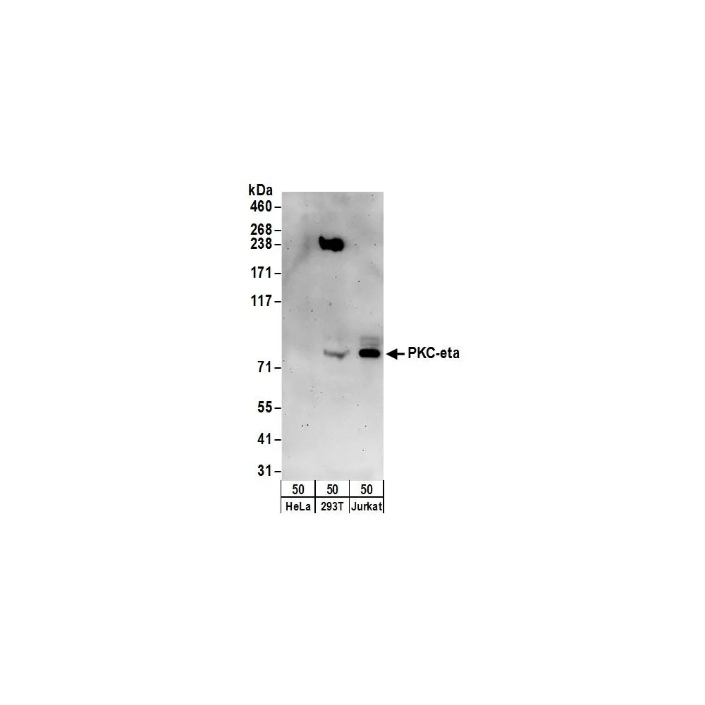 Rabbit anti-PKC-eta Antibody, Affinity Purified