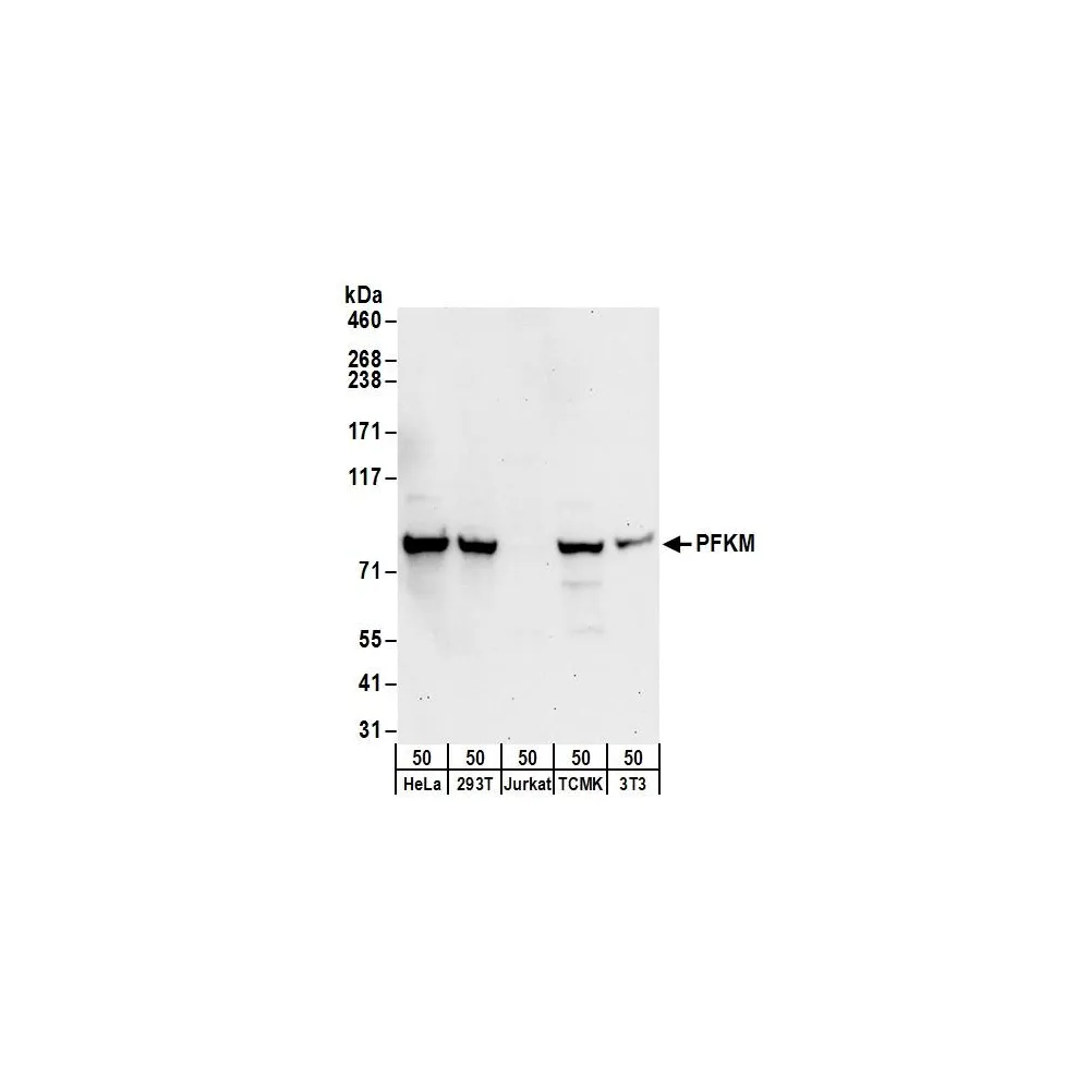 Rabbit anti-PFKM Antibody, Affinity Purified