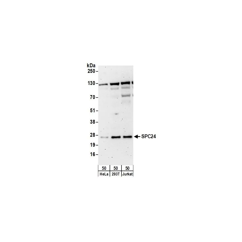 Rabbit anti-SPC24 Antibody, Affinity Purified