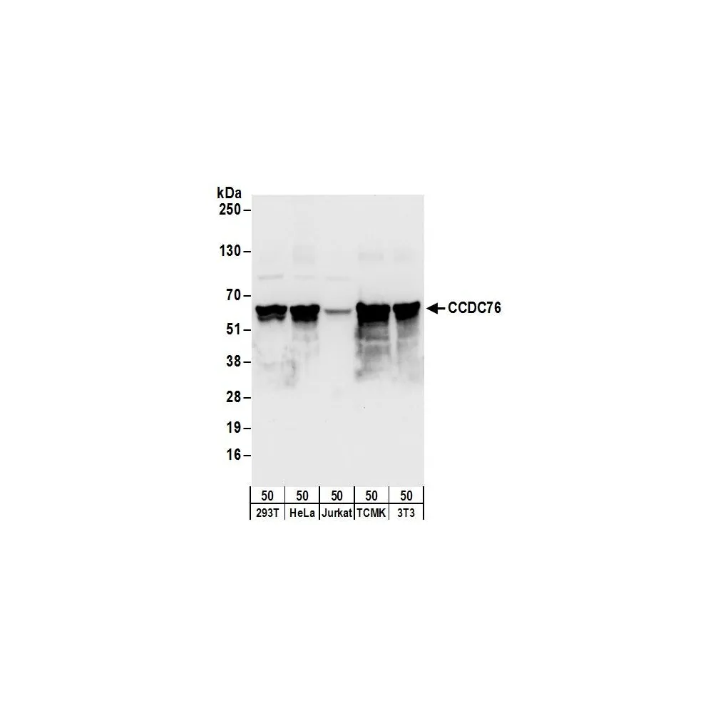 Rabbit anti-CCDC76 Antibody, Affinity Purified