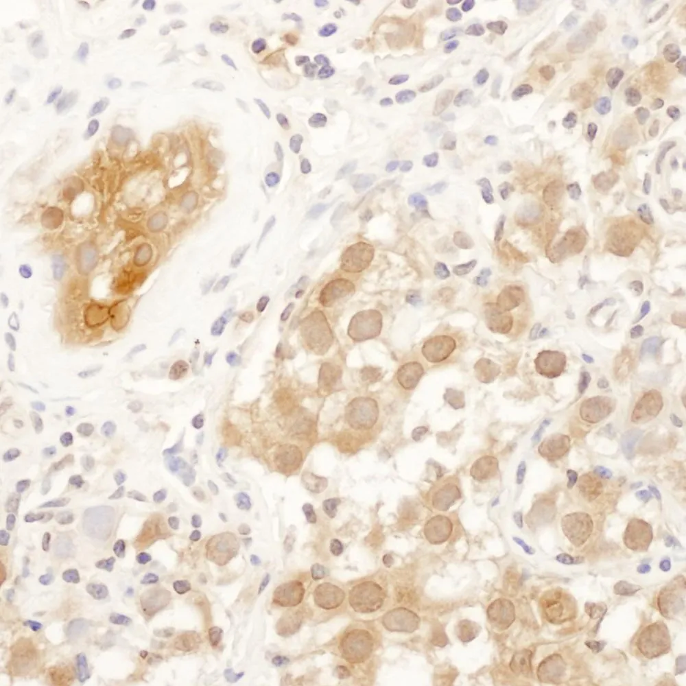 Rabbit anti-FNTA Antibody, Affinity Purified