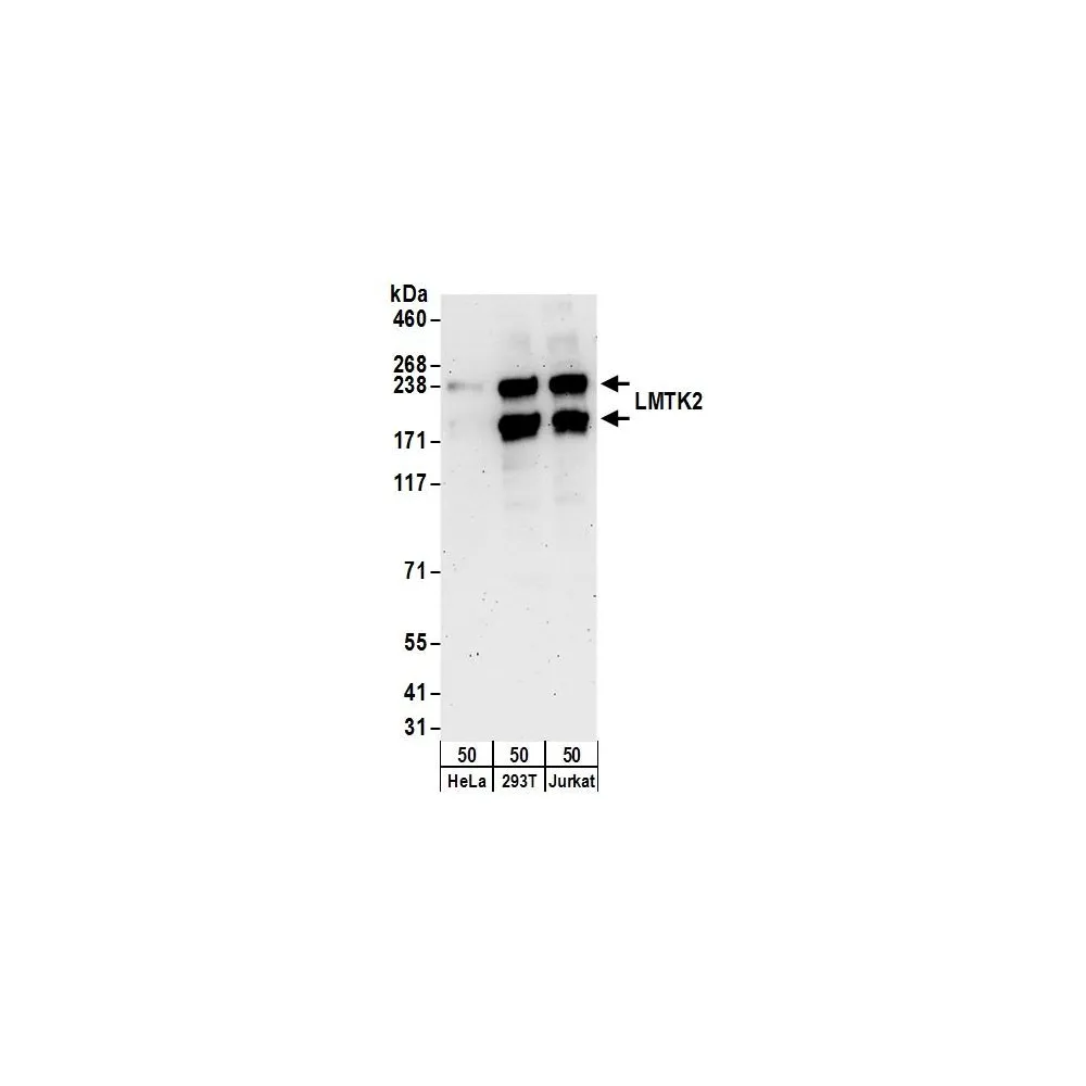 Rabbit anti-LMTK2 Antibody, Affinity Purified