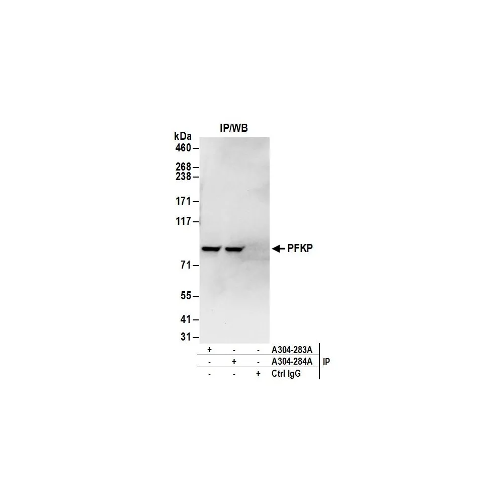 Rabbit anti-PFKP Antibody, Affinity Purified